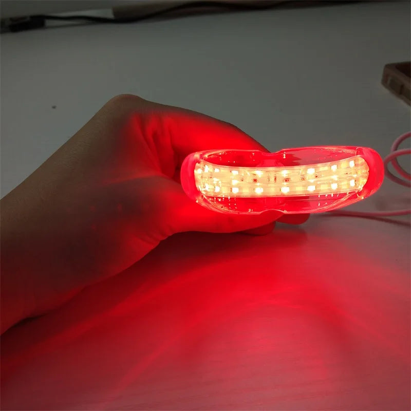 Tooth Sores Cure Reliever Gingivitis Therapy LED Red Light Therapentic Device - Cashdust