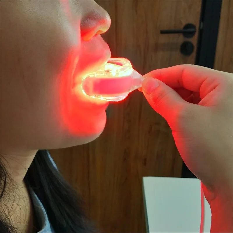 Tooth Sores Cure Reliever Gingivitis Therapy LED Red Light Therapentic Device - Cashdust