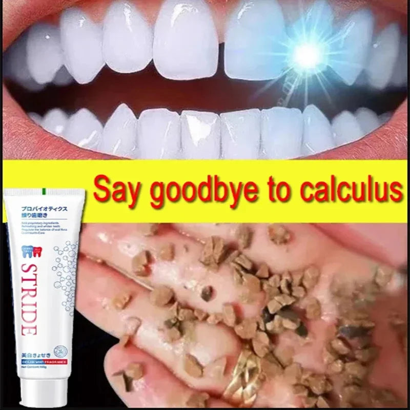 Dental Calculus Remover Whitening Removal Bad Breath Teeth Toothpaste Brightening Preventing Periodontitis Dental Cleansing Care - Cashdust