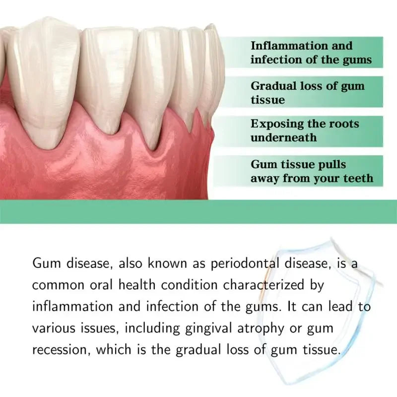 Quickly Repair Of Cavities Caries Mousse Teeth Clean Whiten Remove Yellow Plaque Stains Relieve Gums Decay Toothache 2024 - Cashdust