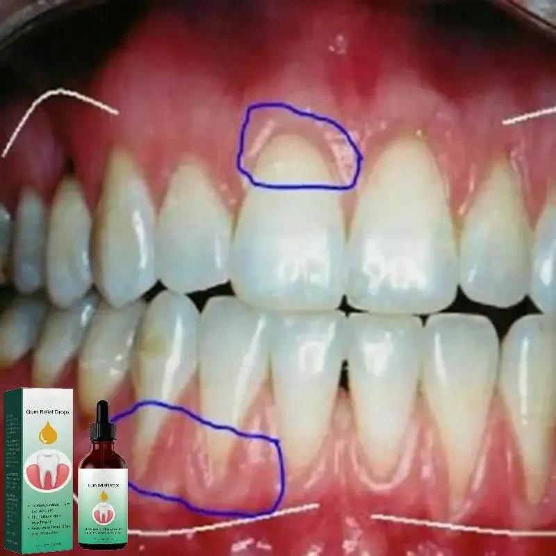 Quickly Repair Of Cavities Caries Teeth Clean Whiten Remove Yellow Plaque Stains Relieve Gums Decay Toothache Toothpaste New - Cashdust